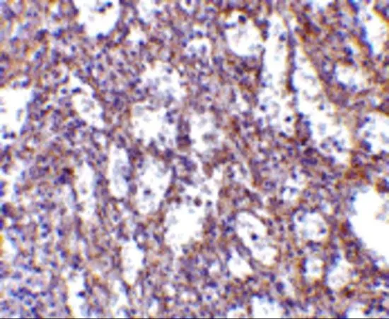 IHC-P analysis of human spleen tissue using GTX85070 IL32 antibody. Working concentration : 10 microg/ml IHC-P analysis of human spleen tissue using GTX85070 IL32 antibody. Working concentration : 10 microg/ml