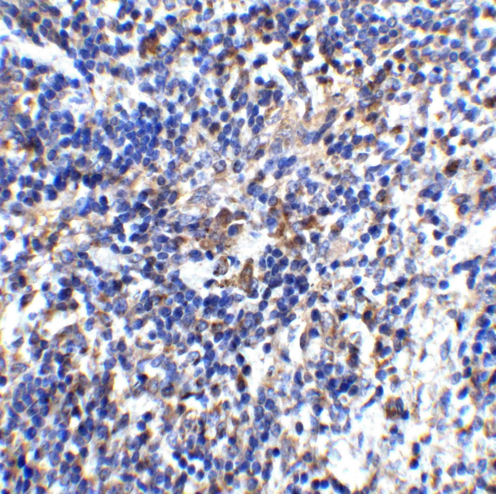 IHC-P analysis of mouse spleen tissue using GTX85070 IL32 antibody. Dilution : 2 microg/ml