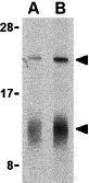 WB analysis of human spleen tissue lysate using GTX85070 IL32 antibody. Working concentration : (A) 5 and (B) 10 microg/ml
