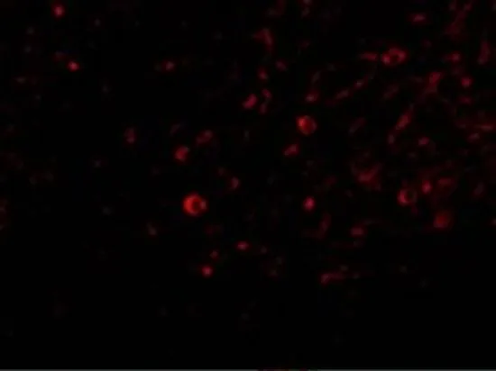 IHC-P analysis of human spleen tissue using GTX85070 IL32 antibody. Working concentration : 20 microg/ml