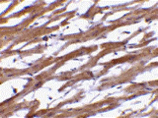 IHC-P analysis of human heart tissue using GTX85073 BAP29 antibody. Working concentration : 10 microg/ml IHC-P analysis of human heart tissue using GTX85073 BAP29 antibody. Working concentration : 10 microg/ml