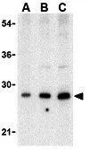 WB analysis of human heart tissue lysate using GTX85073 BAP29 antibody. Working concentration : (A) 0.5, (B) 1, and (C) 2 microg/ml