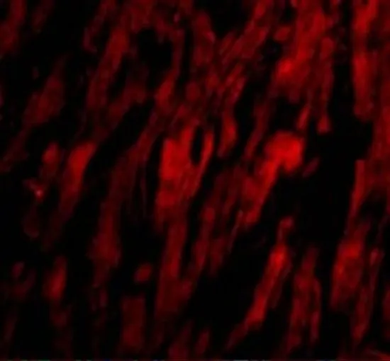 IHC-P analysis of human heart tissue using GTX85073 BAP29 antibody. Working concentration : 20 microg/ml