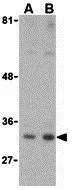 WB analysis of MDA-MD-361 cell lysate using GTX85080 CTRP1 antibody. Working concentration : (A) 1 and (B) 2 microg/ml WB analysis of MDA-MD-361 cell lysate using GTX85080 CTRP1 antibody. Working concentration : (A) 1 and (B) 2 microg/ml