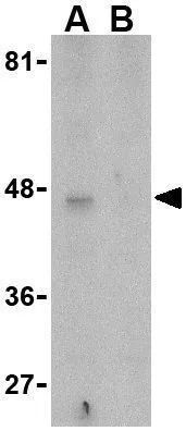 WB analysis of Caco-2 cell lysate in the (A)absence and (B) presence of blocking peptide using GTX85084 APOBEC3G antibody. Working concentration : 5 microg/ml