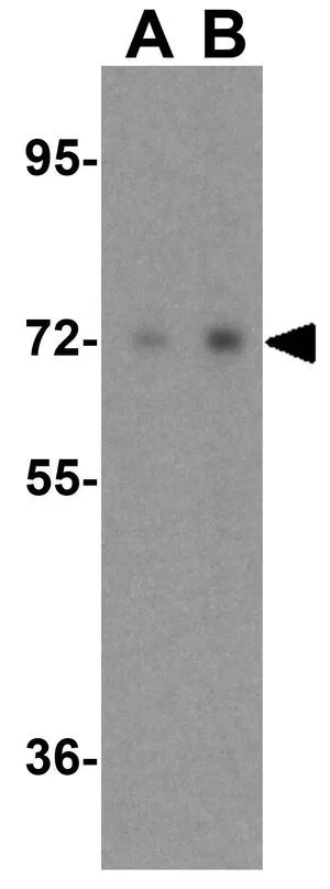 WB analysis of A431 cell lysate using GTX85101 Raf1 antibody. Working concentration : (A) 0.5 and (B) 1 microg/ml WB analysis of A431 cell lysate using GTX85101 Raf1 antibody. Working concentration : (A) 0.5 and (B) 1 microg/ml