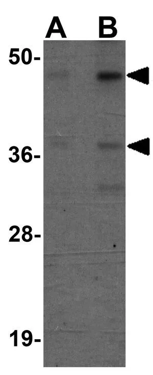 WB analysis of 293 cell lysate using GTX85103 SIRT7 antibody. Working concentration : (A) 0.5 and (B) 1 microg/ml WB analysis of 293 cell lysate using GTX85103 SIRT7 antibody. Working concentration : (A) 0.5 and (B) 1 microg/ml