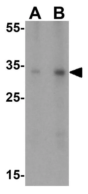 WB analysis of A431 cell lysate using GTX85104 SIRT5 antibody. Working concentration : (A) 1 and (B) 2 microg/ml WB analysis of A431 cell lysate using GTX85104 SIRT5 antibody. Working concentration : (A) 1 and (B) 2 microg/ml