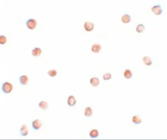ICC/IF analysis of Jurkat cells using GTX85107 FAM82A1 antibody. Working concentration : 5 microg/ml