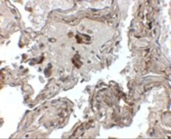 IHC-P analysis of human lung tissue using GTX85112 Prealbumin antibody. Working concentration : 2.5 microg/ml IHC-P analysis of human lung tissue using GTX85112 Prealbumin antibody. Working concentration : 2.5 microg/ml