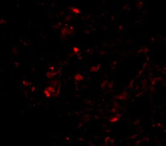 IHC-P analysis of human lung tissue using GTX85112 Prealbumin antibody. Working concentration : 20 microg/ml