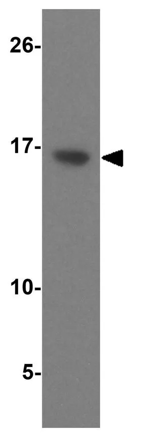 WB analysis of 125 ng Transthyretin recombinant protein using GTX85112 Prealbumin antibody. Working concentration : 1 microg/ml
