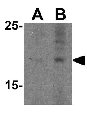 WB analysis of HepG2 cell lysate using GTX85112 Prealbumin antibody. Working concentration : (A) 1 and (B) 2 microg/ml