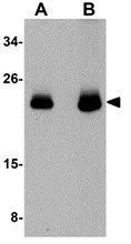 WB analysis of human brain tissue lysate using GTX85114 CDC42 antibody. Working concentration : (A) 0.5 and (B) 1 ug/ml
