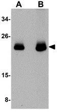 WB analysis of human brain tissue lysate using GTX85114 CDC42 antibody. Working concentration : (A) 0.5 and (B) 1 microg/ml WB analysis of human brain tissue lysate using GTX85114 CDC42 antibody. Working concentration : (A) 0.5 and (B) 1 microg/ml