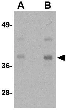 WB analysis of HeLa cell lysate using GTX85117 beta Actin antibody. Working concentration : (A) 1 and (B) 2 microg/ml WB analysis of HeLa cell lysate using GTX85117 beta Actin antibody. Working concentration : (A) 1 and (B) 2 microg/ml