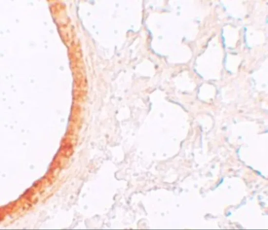 IHC-P analysis of mouse lung tissue using GTX85133 ZIP3 antibody. Working concentration : 5 microg/ml IHC-P analysis of mouse lung tissue using GTX85133 ZIP3 antibody. Working concentration : 5 microg/ml