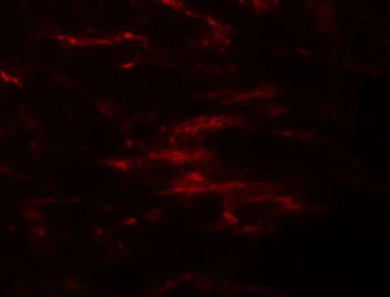 IHC-P analysis of human brain tissue using GTX85134 SLC39A2 antibody. Working concentration : 20 microg/ml
