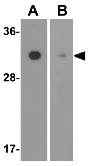 WB analysis of (A) mouse and (B) rat brain tissue lysate using GTX85134 SLC39A2 antibody. Working concentration : 1 microg/ml