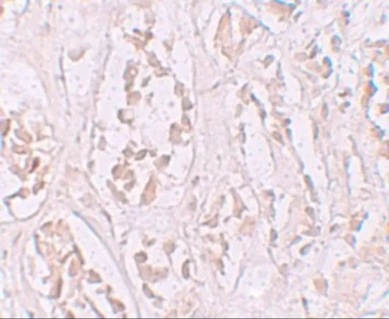 IHC-P analysis of human kidney tissue using GTX85136 STOX2 antibody. Working concentration : 2.5 microg/ml IHC-P analysis of human kidney tissue using GTX85136 STOX2 antibody. Working concentration : 2.5 microg/ml