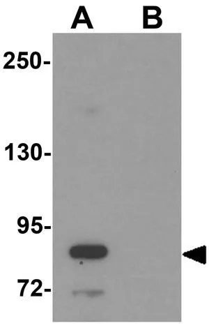 WB analysis of human kidney tissue lysate in (A) the absence and (B) the presence of blocking peptide using GTX85136 STOX2 antibody. Working concentration : 1 microg/ml