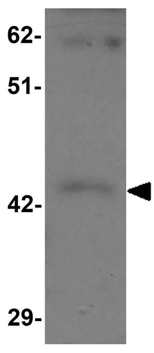 WB analysis of rat brain tissue lysate using GTX85137 SHISA9 antibody. Working concentration : 1 microg/ml
