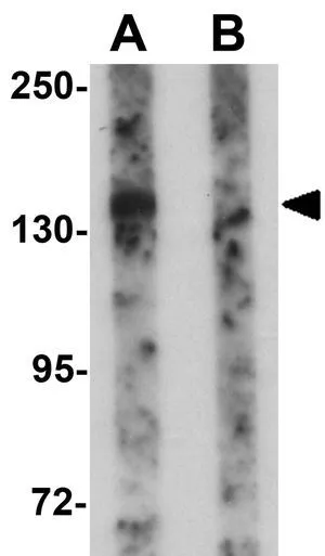 WB analysis of rat kidney tissue lysate in (A) the absence and (B) the presence of blocking peptide using GTX85138 PEAR1 antibody. Working concentration : 1 microg/ml