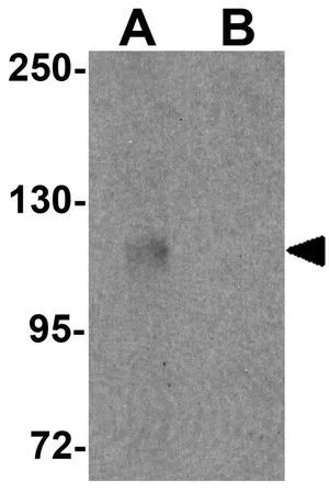 WB analysis of 3T3 cell lysate in (A) the absence and (B) the presence of blocking peptide using GTX85145 PIWIL3 antibody. Working concentration : 1 microg/ml WB analysis of 3T3 cell lysate in (A) the absence and (B) the presence of blocking peptide using GTX85145 PIWIL3 antibody. Working concentration : 1 microg/ml