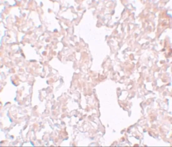 IHC-P analysis of rat lung tissue using GTX85148 MFSD1 antibody. Working concentration : 10 microg/ml IHC-P analysis of rat lung tissue using GTX85148 MFSD1 antibody. Working concentration : 10 microg/ml