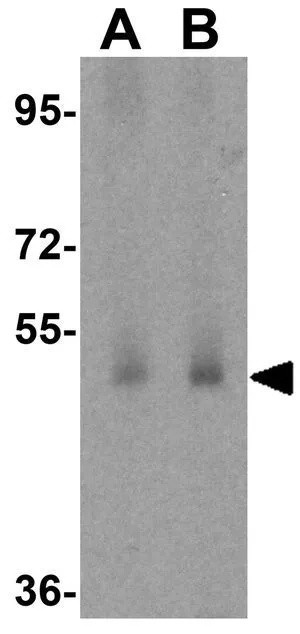 WB analysis of human testis tissue lysate using GTX85148 MFSD1 antibody. Working concentration : (A) 1 and (B) 2 microg/ml