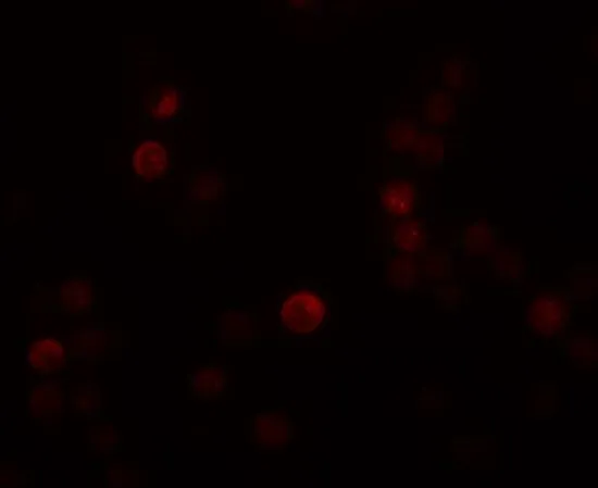 ICC/IF analysis of HeLa cells using GTX85149 PLAC4 antibody. Working concentration : 20 microg/ml
