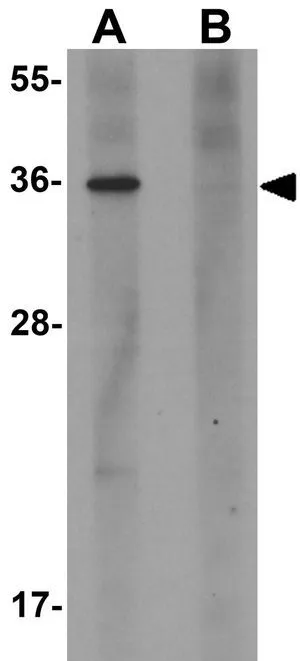 WB analysis of human placenta tissue lysate in (A) the absence and (B) the presence of blocking peptide using GTX85151 PLAC1 antibody. Working concentration : 1 microg/ml WB analysis of human placenta tissue lysate in (A) the absence and (B) the presence of blocking peptide using GTX85151 PLAC1 antibody. Working concentration : 1 microg/ml