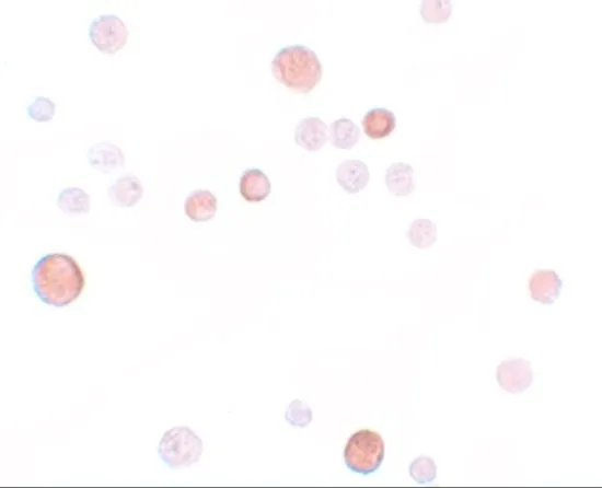 ICC/IF analysis of HeLa cells using GTX85151 PLAC1 antibody. Working concentration : 10 microg/ml