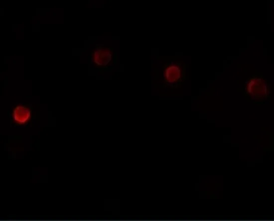 ICC/IF analysis of HeLa cells using GTX85151 PLAC1 antibody. Working concentration : 20 microg/ml