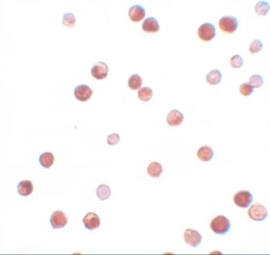 ICC/IF analysis of HeLa cells using GTX85153 NALP11 antibody. Working concentration : 2.5 microg/ml