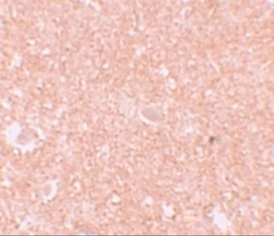 IHC-P analysis of human brain tissue using GTX85154 NALP10 antibody. Working concentration : 10 microg/ml IHC-P analysis of human brain tissue using GTX85154 NALP10 antibody. Working concentration : 10 microg/ml