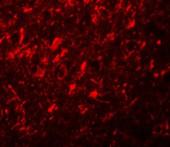 IHC-P analysis of human brain tissue using GTX85154 NALP10 antibody. Working concentration : 20 microg/ml