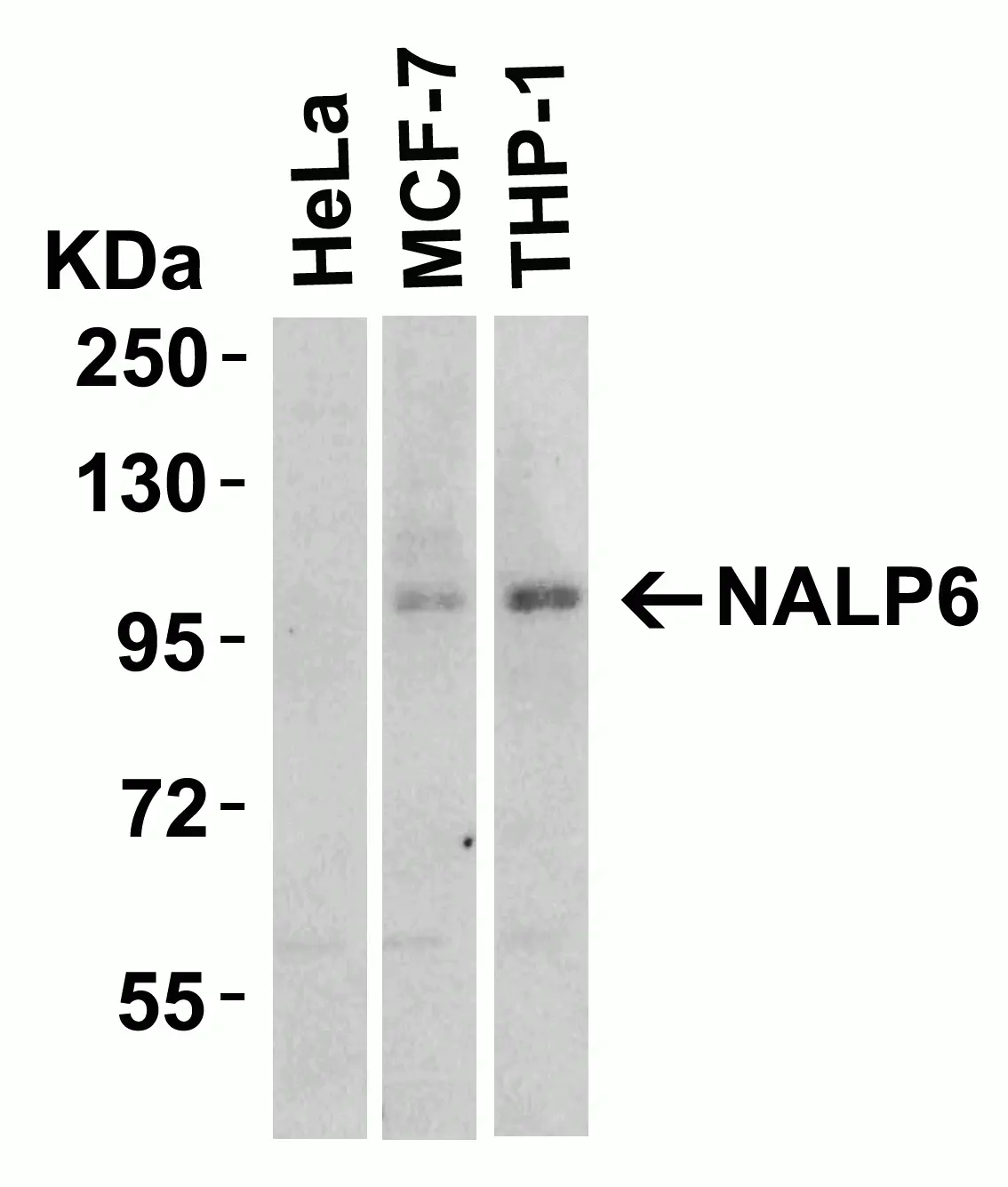 WB analysis of various samples using GTX85157 NALP6 antibody. Dilution : 2 microg/ml