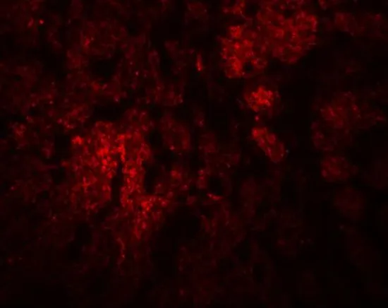 IHC-P analysis of rat brain tissue using GTX85167 CCDC106 antibody. Working concentration : 20 microg/ml