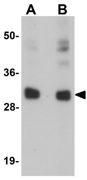 WB analysis of human brain tissue lysate using GTX85167 CCDC106 antibody. Working concentration : (A) 0.5 and (B) 1 microg/ml
