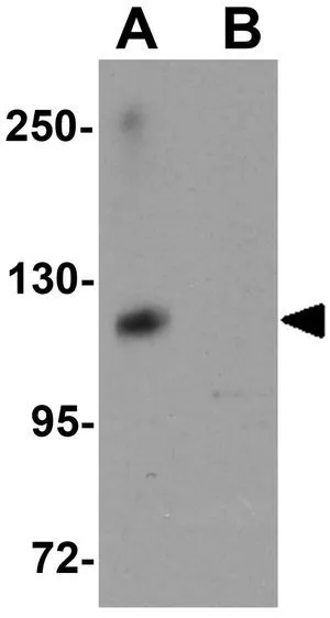 WB analysis of K562 cell tissue lysate in (A) the absence and (B) the presence of blocking peptide using GTX85170 ATP11A antibody. Working concentration : 1 microg/ml WB analysis of K562 cell tissue lysate in (A) the absence and (B) the presence of blocking peptide using GTX85170 ATP11A antibody. Working concentration : 1 microg/ml
