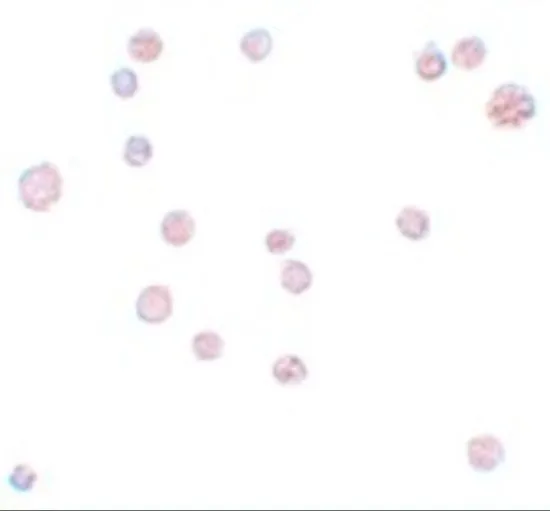 ICC/IF analysis of K562 cells using GTX85170 ATP11A antibody. Working concentration : 10 microg/ml