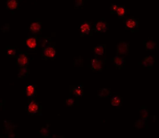 ICC/IF analysis of K562 cells using GTX85170 ATP11A antibody. Working concentration : 20 microg/ml