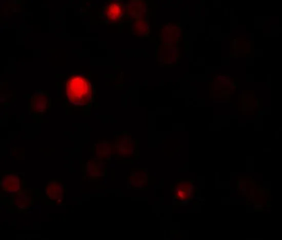 ICC/IF analysis of HeLa cells using GTX85175 TCTN3 antibody. Working concentration : 20 microg/ml