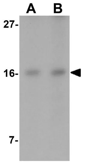 WB analysis of Jurkat cell lysate using GTX85182 IFITM1 antibody. Working concentration : (A) 2.5 and (B) 5 microg/ml WB analysis of Jurkat cell lysate using GTX85182 IFITM1 antibody. Working concentration : (A) 2.5 and (B) 5 microg/ml