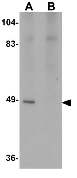 WB analysis of rat heart tissue lysate in (A) the absence and (B) the presence of blocking peptide using GTX85183 ATG13 antibody. Working concentration : 1 microg/ml