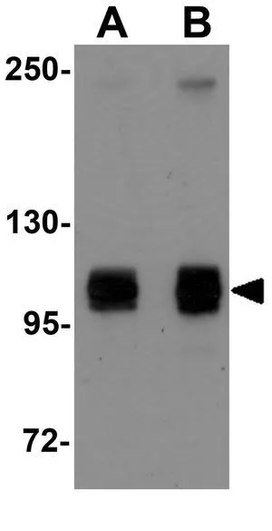 WB analysis of HeLa cell lysate using GTX85184 ATG9B antibody. Working concentration : (A) 1 and (B) 2 microg/ml WB analysis of HeLa cell lysate using GTX85184 ATG9B antibody. Working concentration : (A) 1 and (B) 2 microg/ml