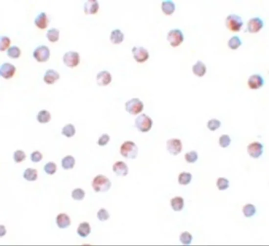ICC/IF analysis of HeLa cells using GTX85184 ATG9B antibody. Working concentration : 10 microg/ml