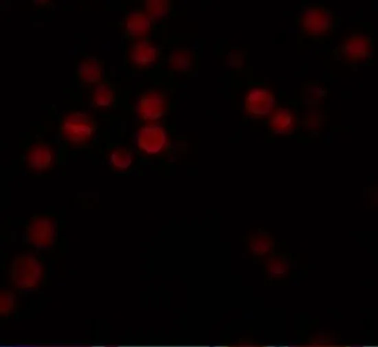 ICC/IF analysis of HeLa cells using GTX85184 ATG9B antibody. Working concentration : 20 microg/ml