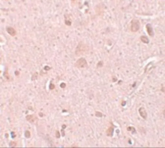 IHC-P analysis of human brain tissue using GTX85188 TINP1 antibody. Working concentration : 5 microg/ml IHC-P analysis of human brain tissue using GTX85188 TINP1 antibody. Working concentration : 5 microg/ml